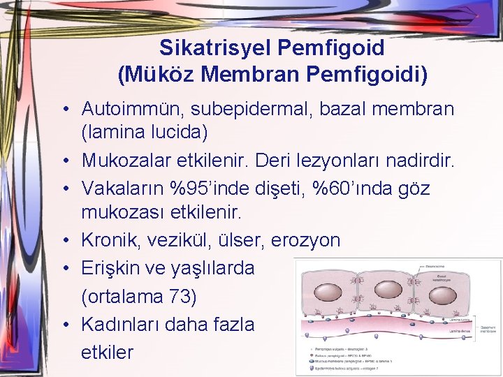 Sikatrisyel Pemfigoid (Müköz Membran Pemfigoidi) • Autoimmün, subepidermal, bazal membran (lamina lucida) • Mukozalar