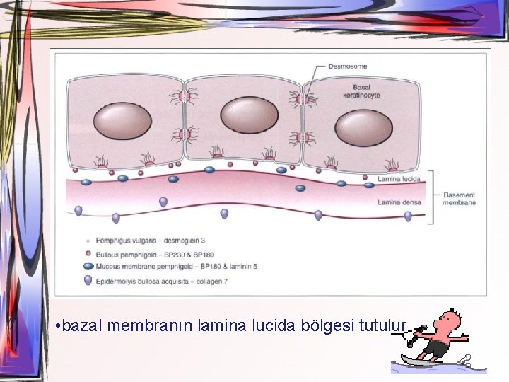  • bazal membranın lamina lucida bölgesi tutulur 