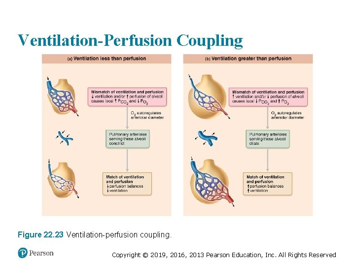 Ventilation-Perfusion Coupling Figure 22. 23 Ventilation-perfusion coupling. Copyright © 2019, 2016, 2013 Pearson Education,