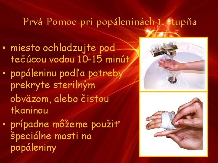 Prvá Pomoc pri popáleninách 1. stupňa • miesto ochladzujte pod tečúcou vodou 10 -15