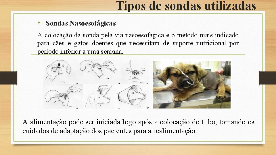 Tipos de sondas utilizadas • Sondas Nasoesofágicas A colocação da sonda pela via nasoesofágica