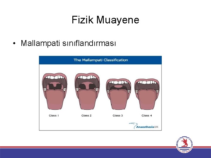 Fizik Muayene • Mallampati sınıflandırması 