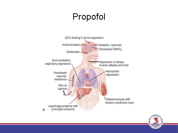 Propofol 