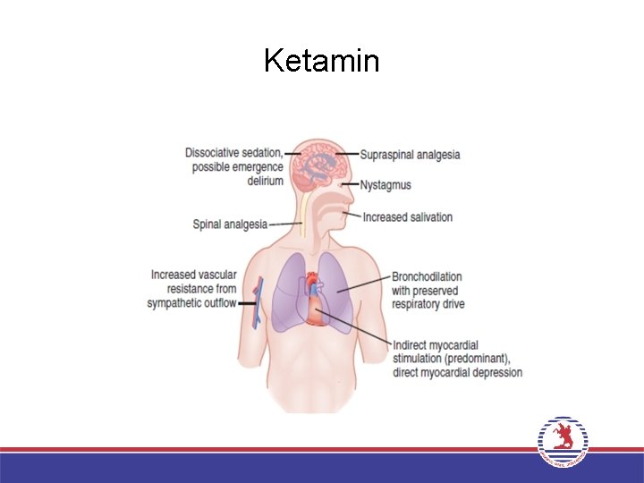 Ketamin 