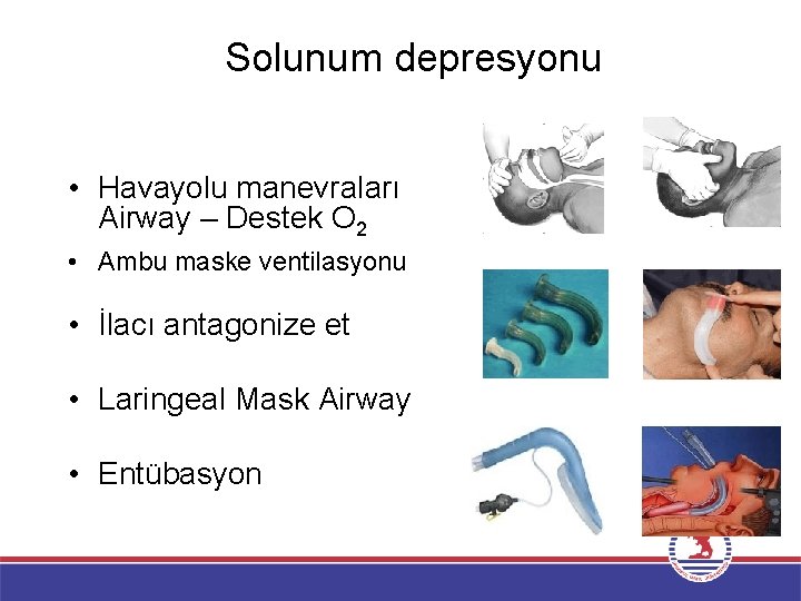 Solunum depresyonu • Havayolu manevraları Airway – Destek O 2 • Ambu maske ventilasyonu