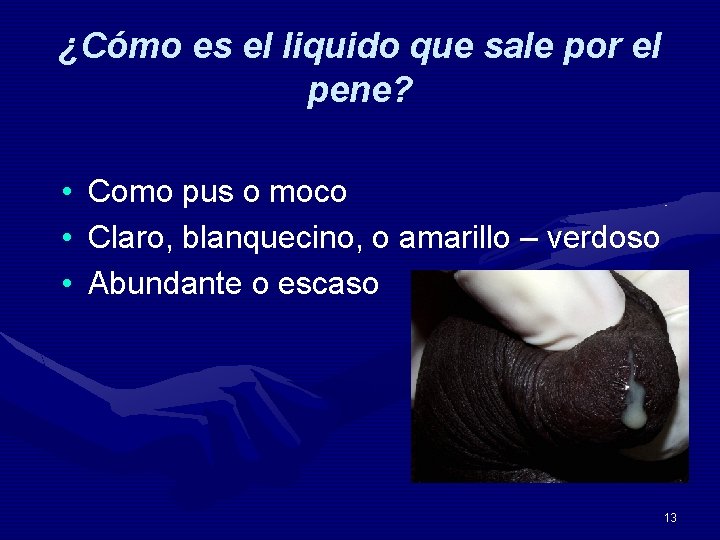 ¿Cómo es el liquido que sale por el pene? • • • Como pus