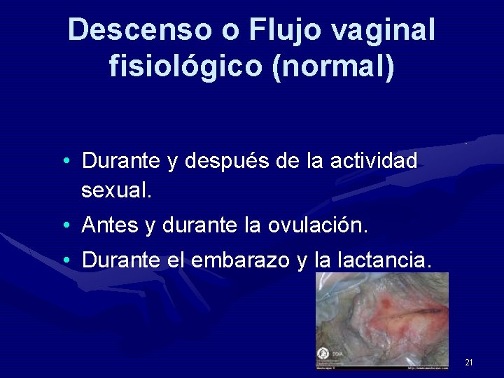 Descenso o Flujo vaginal fisiológico (normal) • Durante y después de la actividad sexual.