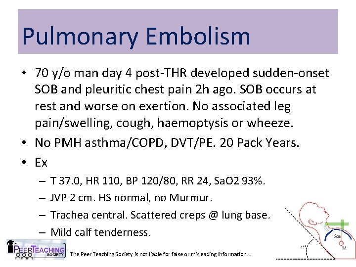 Pulmonary Embolism • 70 y/o man day 4 post-THR developed sudden-onset SOB and pleuritic