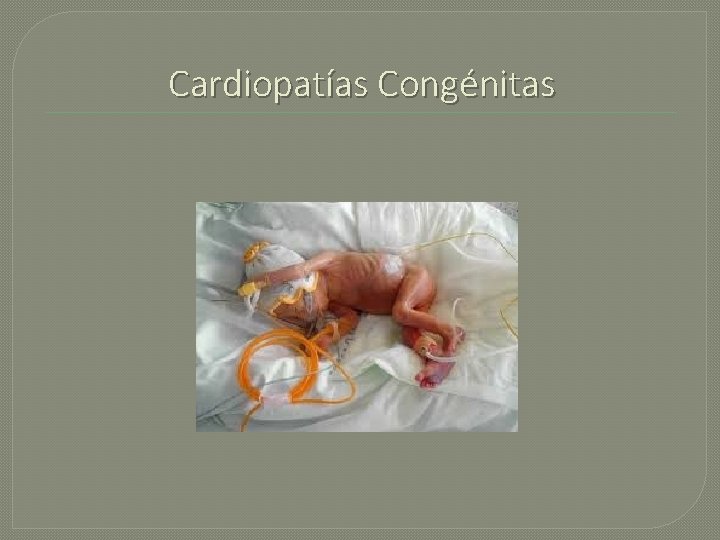 Cardiopatías Congénitas 