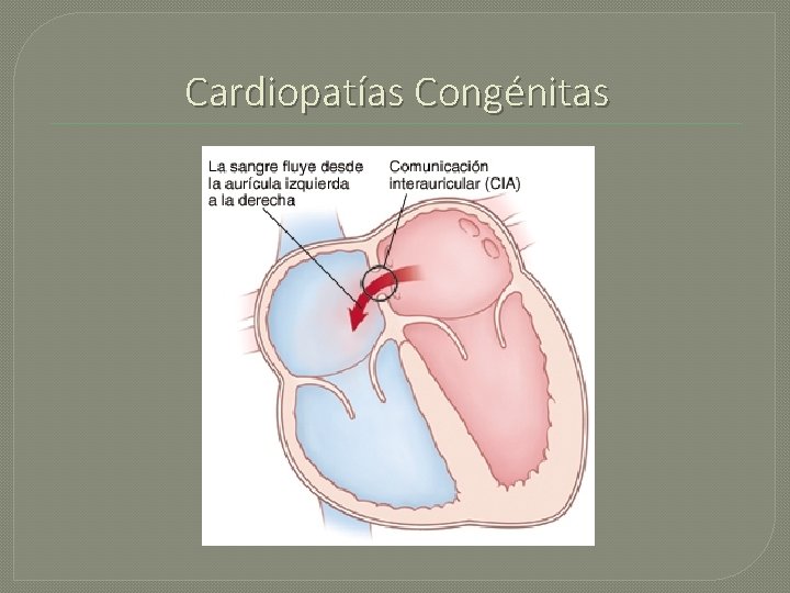 Cardiopatías Congénitas 