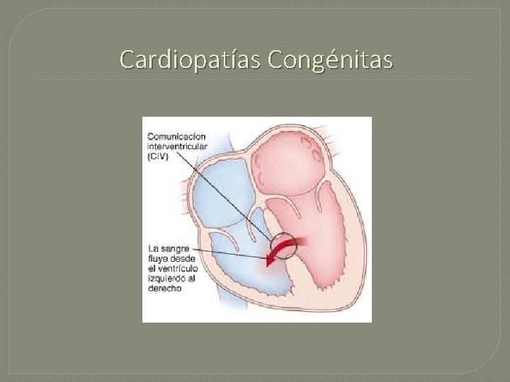 Cardiopatías Congénitas 