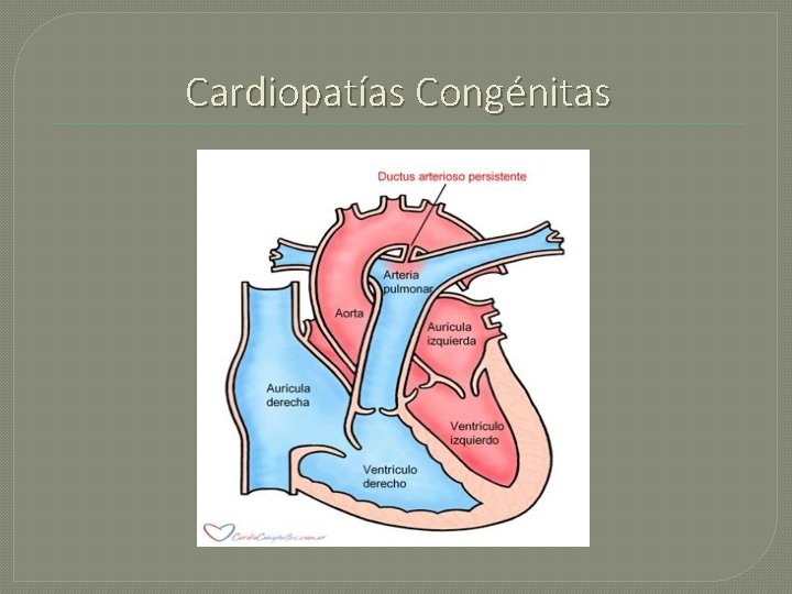 Cardiopatías Congénitas 