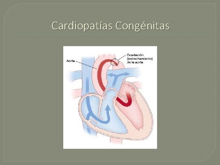 Cardiopatías Congénitas 