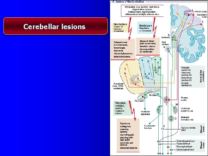Cerebellar lesions 