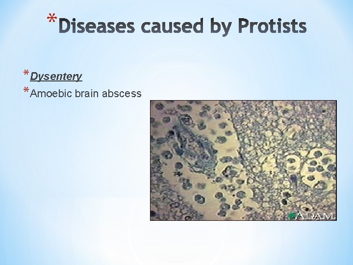 * *Dysentery *Amoebic brain abscess 