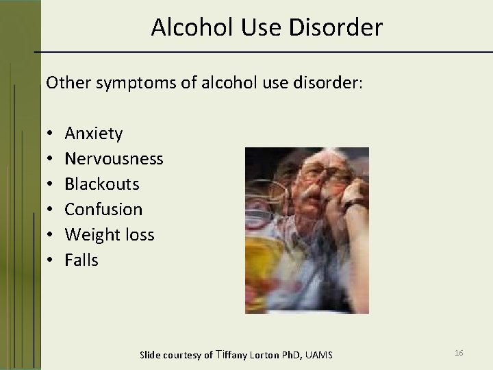 Alcohol Use Disorder Other symptoms of alcohol use disorder: • • • Anxiety Nervousness