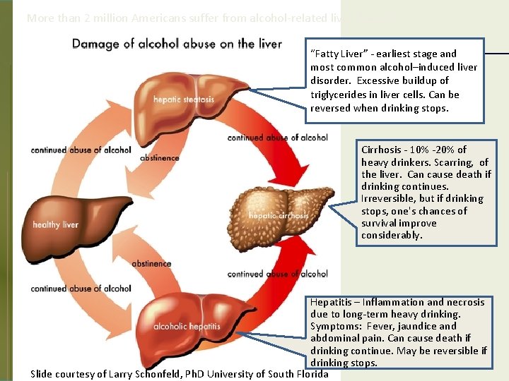 More than 2 million Americans suffer from alcohol-related liver disease. “Fatty Liver” - earliest