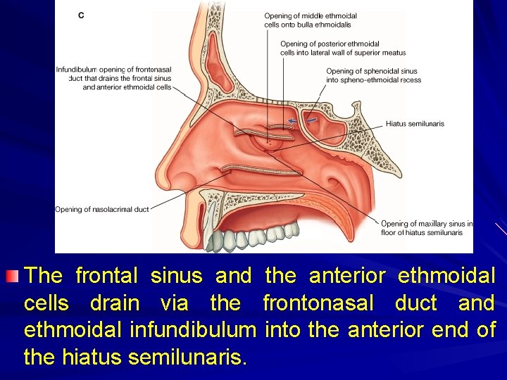 The frontal sinus and the anterior ethmoidal cells drain via the frontonasal duct and