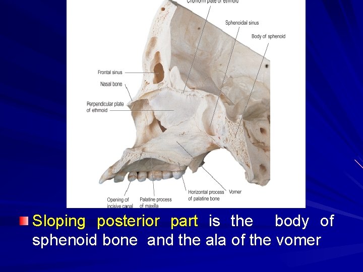 Sloping posterior part is the body of sphenoid bone and the ala of the