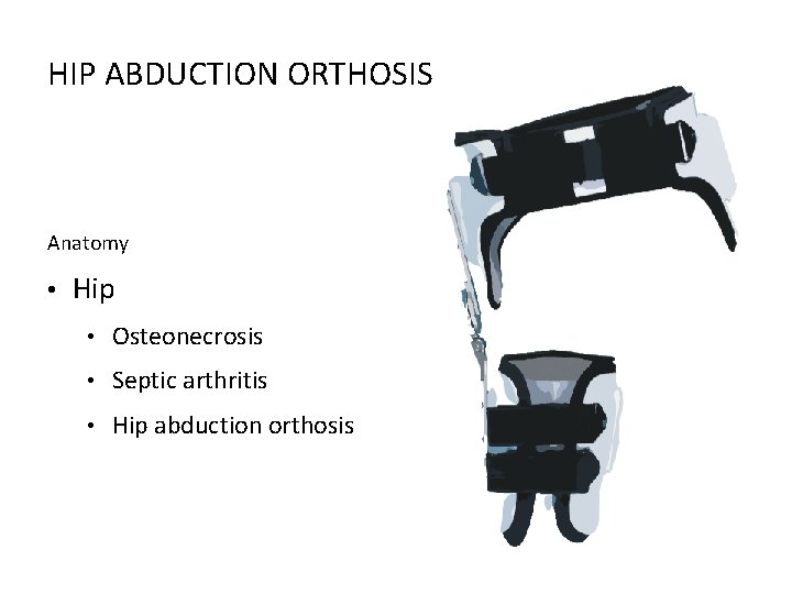 HIP ABDUCTION ORTHOSIS Anatomy • Hip • Osteonecrosis • Septic arthritis • Hip abduction