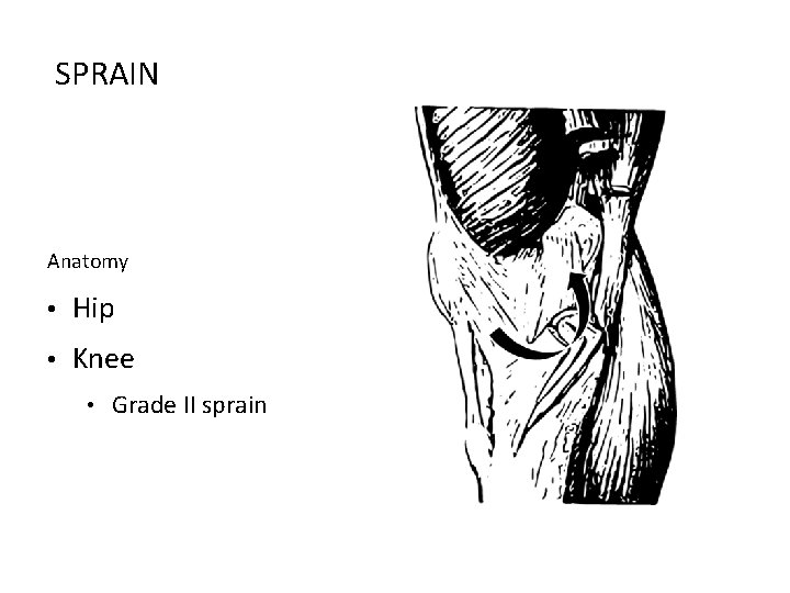 SPRAIN Anatomy • Hip • Knee • Grade II sprain 