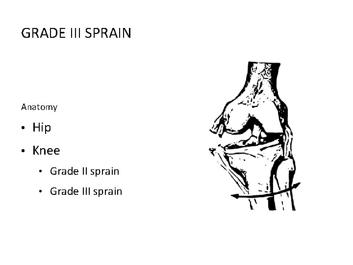 GRADE III SPRAIN Anatomy • Hip • Knee • Grade II sprain • Grade