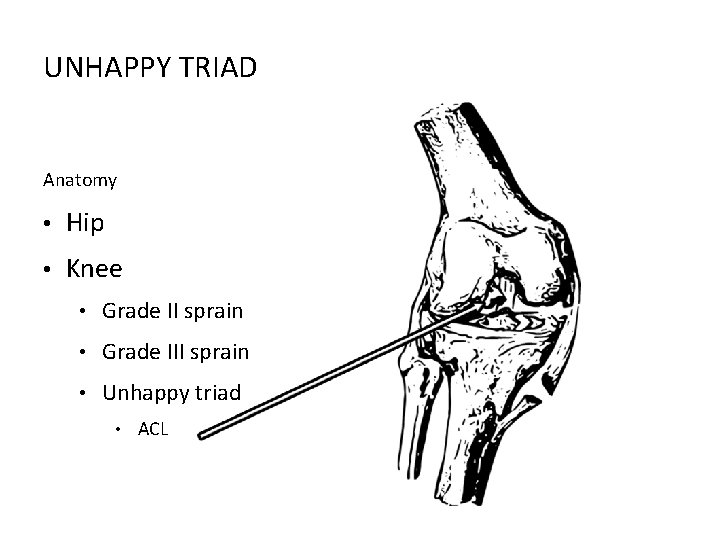 UNHAPPY TRIAD Anatomy • Hip • Knee • Grade II sprain • Grade III