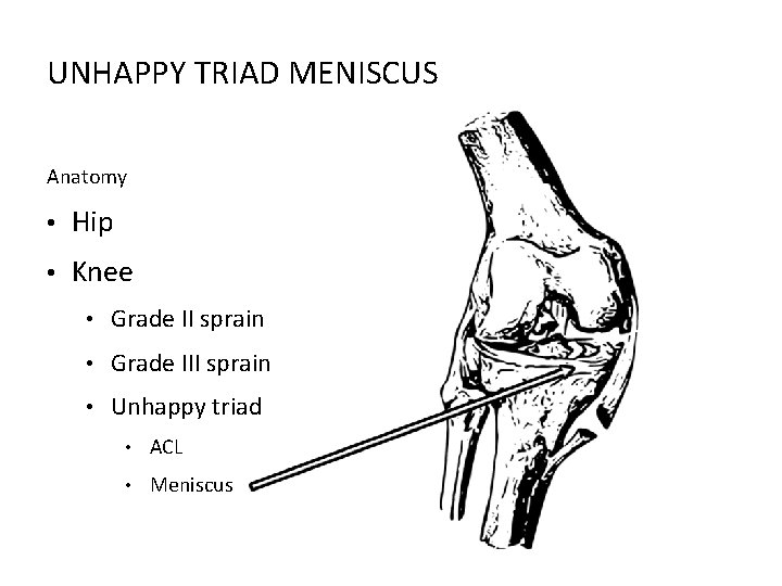 UNHAPPY TRIAD MENISCUS Anatomy • Hip • Knee • Grade II sprain • Grade