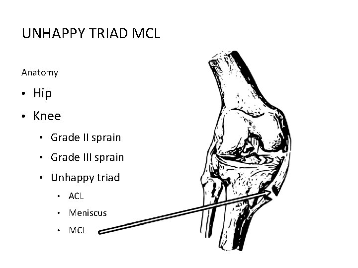 UNHAPPY TRIAD MCL Anatomy • Hip • Knee • Grade II sprain • Grade