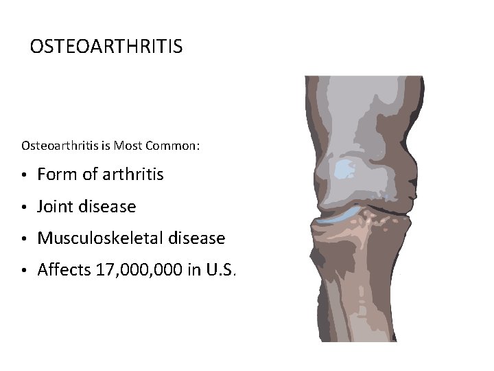 OSTEOARTHRITIS Osteoarthritis is Most Common: • Form of arthritis • Joint disease • Musculoskeletal