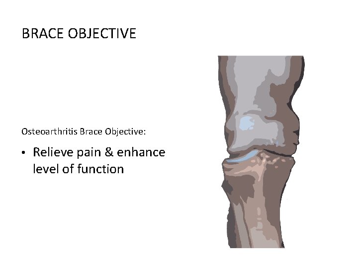 BRACE OBJECTIVE Osteoarthritis Brace Objective: • Relieve pain & enhance level of function 