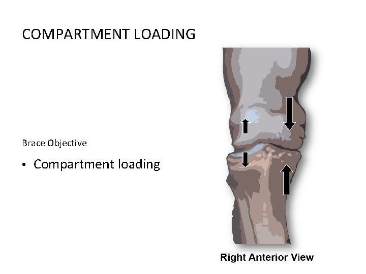 COMPARTMENT LOADING Brace Objective • Compartment loading 