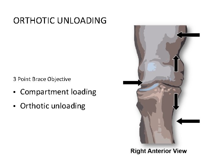 ORTHOTIC UNLOADING 3 Point Brace Objective • Compartment loading • Orthotic unloading 