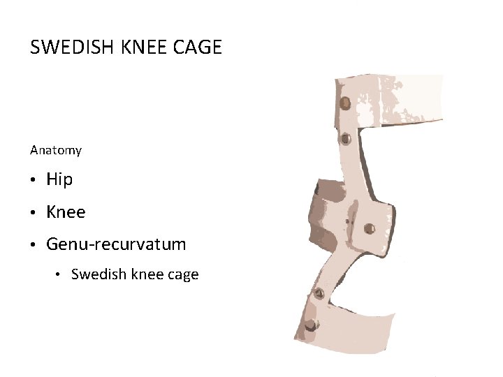 SWEDISH KNEE CAGE Anatomy • Hip • Knee • Genu-recurvatum • Swedish knee cage