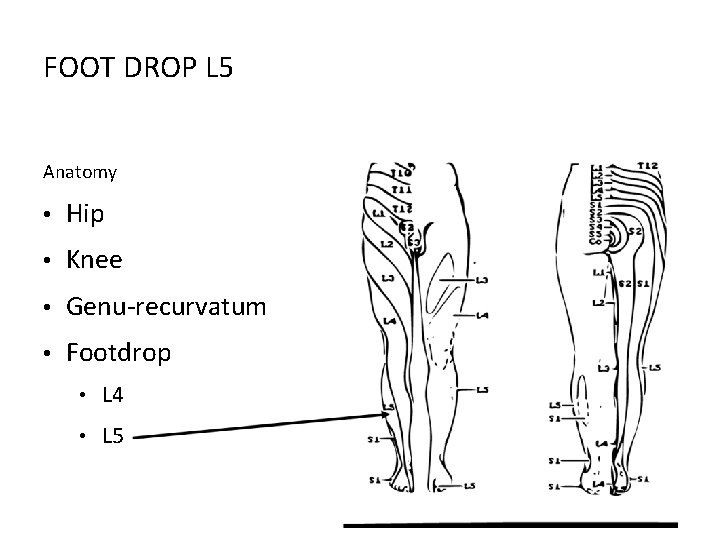 FOOT DROP L 5 Anatomy • Hip • Knee • Genu-recurvatum • Footdrop •