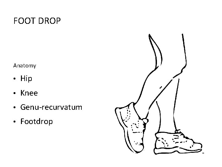 FOOT DROP Anatomy • Hip • Knee • Genu-recurvatum • Footdrop 