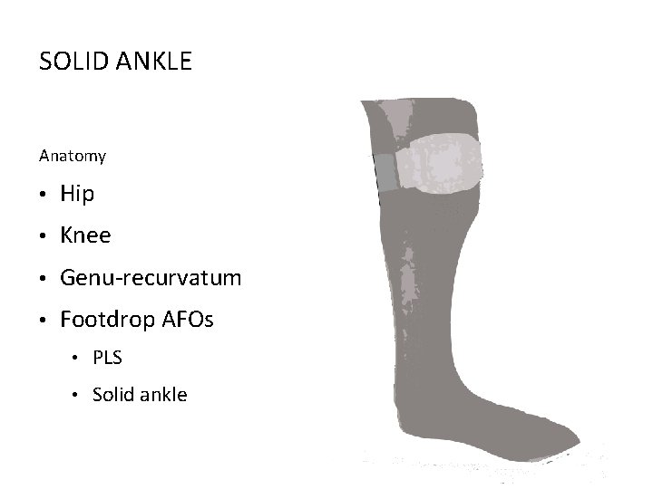 SOLID ANKLE Anatomy • Hip • Knee • Genu-recurvatum • Footdrop AFOs • PLS