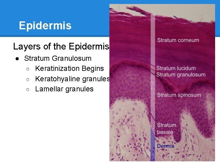 Epidermis Layers of the Epidermis ● Stratum Granulosum ○ Keratinization Begins ○ Keratohyaline granules