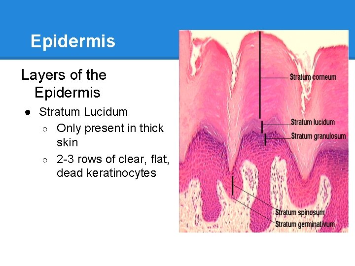 Epidermis Layers of the Epidermis ● Stratum Lucidum ○ Only present in thick skin