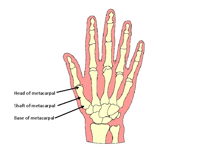 Head of metacarpal Shaft of metacarpal Base of metacarpal 