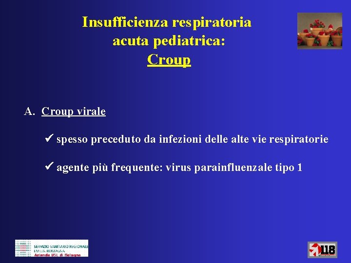 Insufficienza respiratoria acuta pediatrica: Croup A. Croup virale spesso preceduto da infezioni delle alte