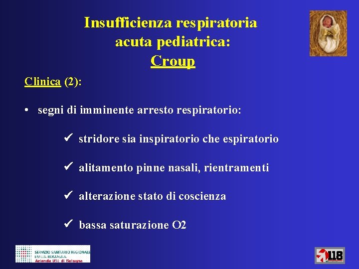 Insufficienza respiratoria acuta pediatrica: Croup Clinica (2): • segni di imminente arresto respiratorio: stridore