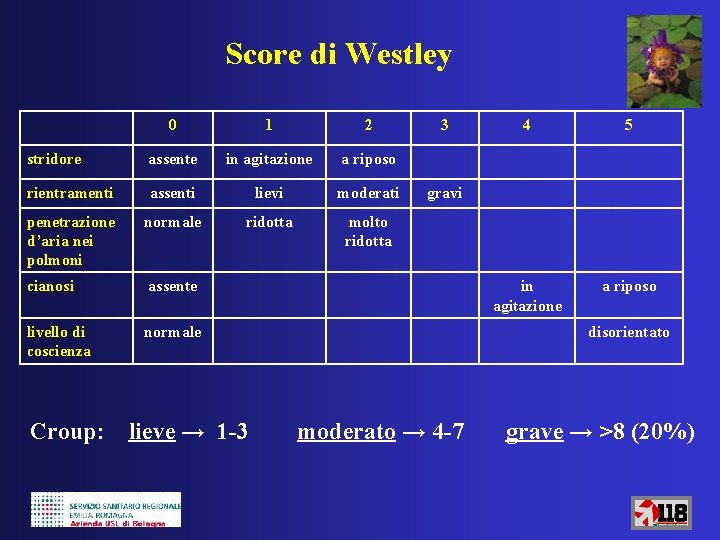 Score di Westley 0 1 2 stridore assente in agitazione a riposo rientramenti assenti