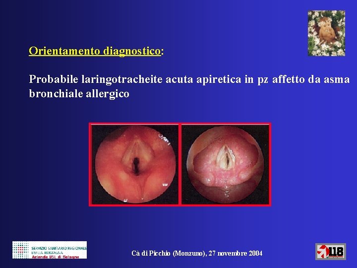 Orientamento diagnostico: Probabile laringotracheite acuta apiretica in pz affetto da asma bronchiale allergico Cà