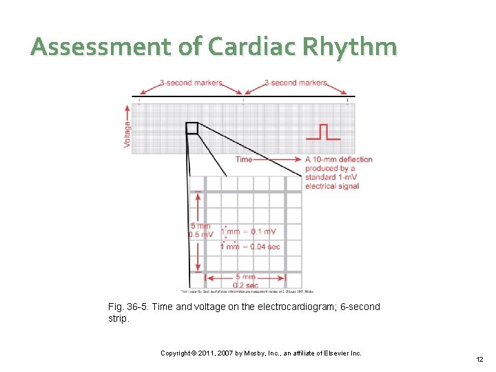 Assessment of Cardiac Rhythm Fig. 36 -5. Time and voltage on the electrocardiogram; 6