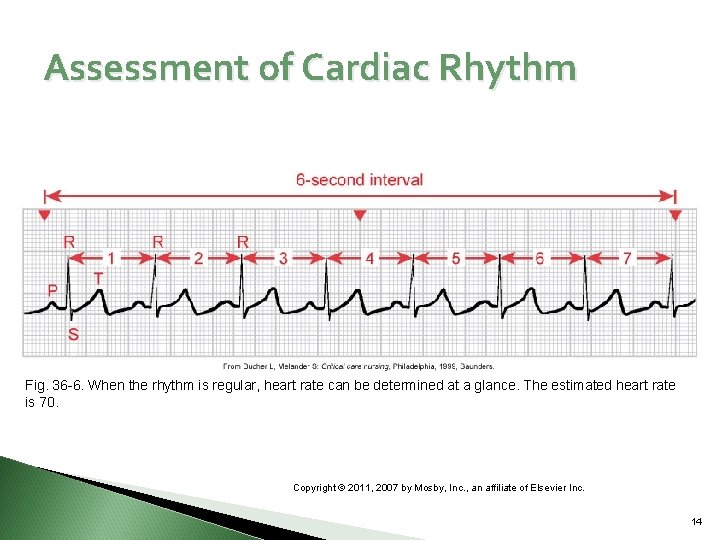 Assessment of Cardiac Rhythm Fig. 36 -6. When the rhythm is regular, heart rate