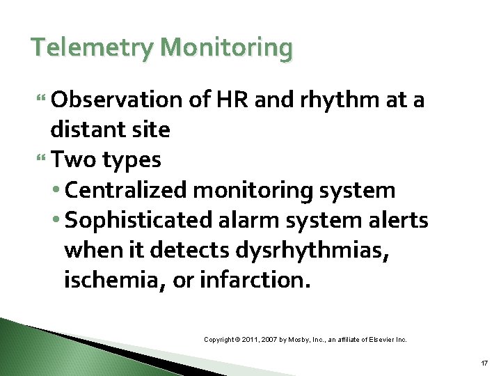 Telemetry Monitoring Observation of HR and rhythm at a distant site Two types •