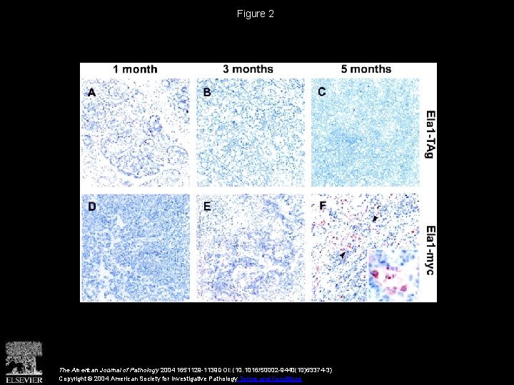 Figure 2 The American Journal of Pathology 2004 1651129 -1139 DOI: (10. 1016/S 0002