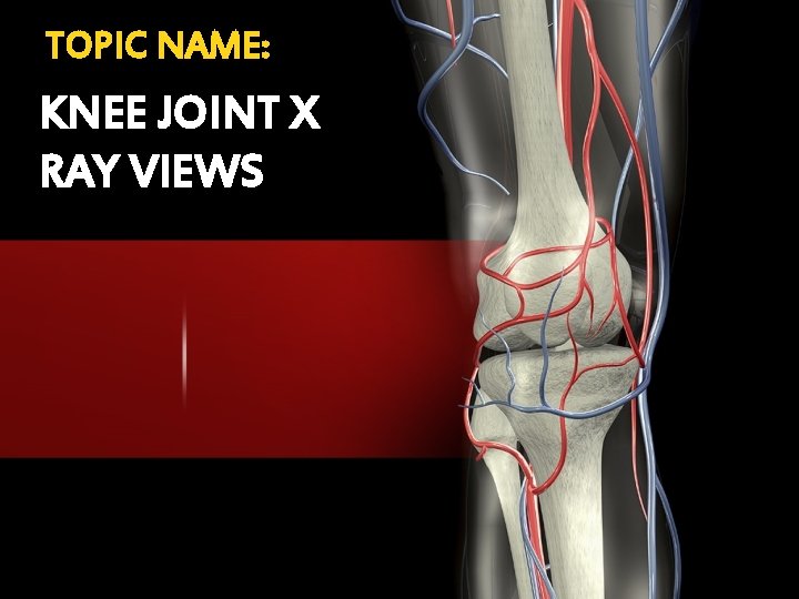TOPIC NAME: KNEE JOINT X RAY VIEWS TOPIC NAME: KNEE JOINT X RAY VIEWS