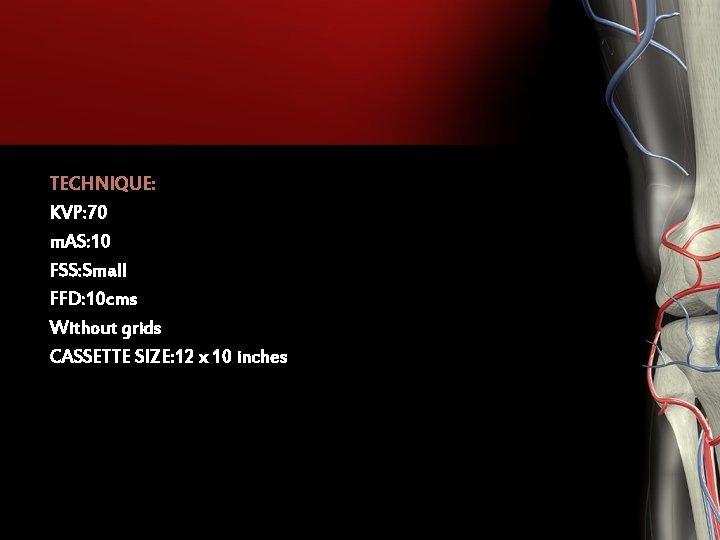 TECHNIQUE: KVP: 70 m. AS: 10 FSS: Small FFD: 10 cms Without grids CASSETTE TECHNIQUE: KVP: 70 m. AS: 10 FSS: Small FFD: 10 cms Without grids CASSETTE